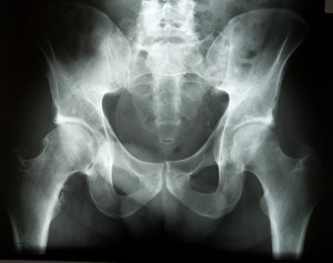 Radiographie